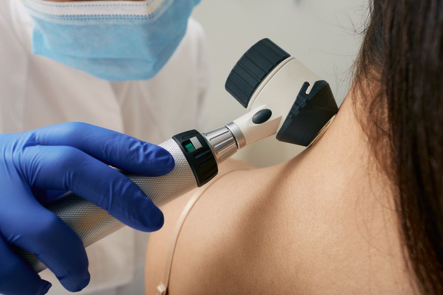 Dermatoscopia: A tecnologia que salva vidas ao avaliar pintas