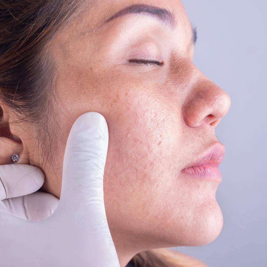 imagem mostra um rosto sendo avaliado com possíveis problemas dermatológicos.